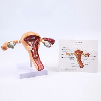 модель женской репродуктивной матки модель больной матки учебное пособие по гинекологической анатомии модель обучения яичникам